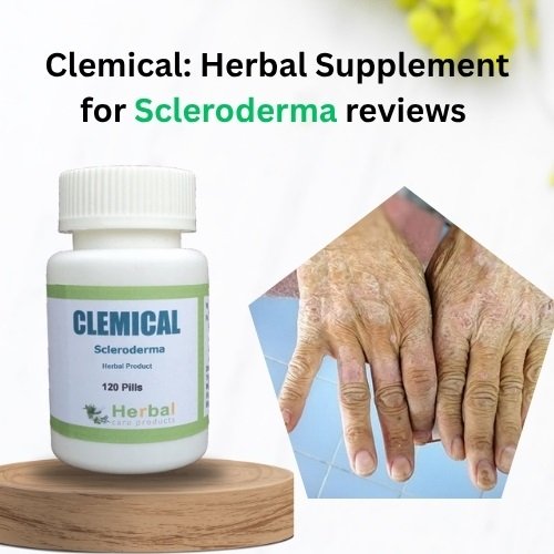 Clemical Herbal Supplement for Scleroderma reviews