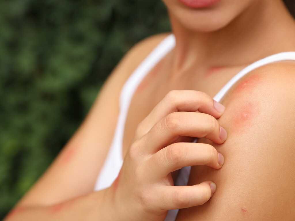 Bullous pemphigoid is a rare but serious skin disorder that causes the epidermis to become thick, red and swollen.